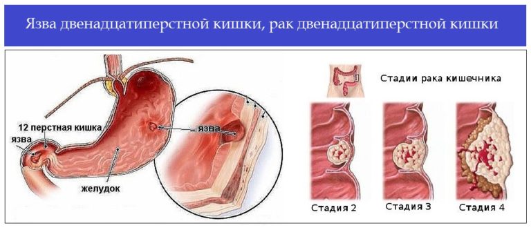   12-    surgery-firstru